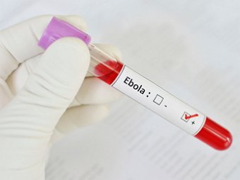 СМИ: В Казахстане с подозрением на Эболу госпитализирован россиянин