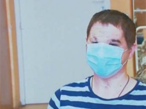 В России впервые провели успешную операцию по пересадке лица