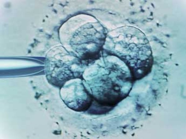 Британским генетикам разрешили вести опыты с человеческими эмбрионами