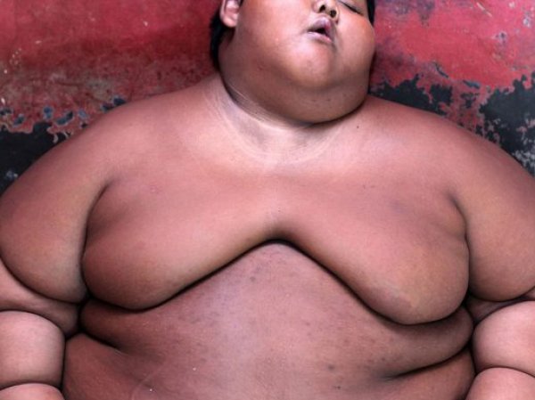Самый толстый ребенок в мире из Индонезии весит 192 кг в 10 лет (ФОТО)