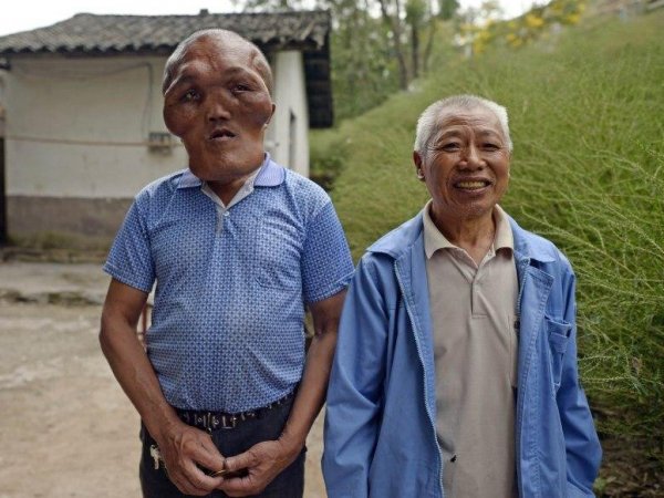 В Китае нашли человека с лицом гуманоида (ФОТО)