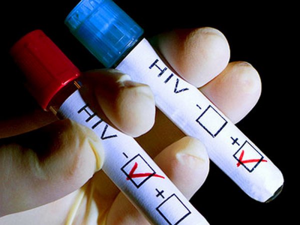 В Великобритании медики первыми в мире вылечили пациента от ВИЧ
