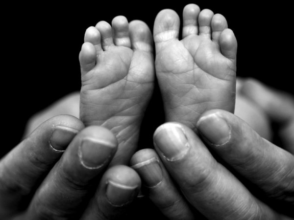 В Мозамбике родился необычный ребенок четырьмя ногами (ФОТО)