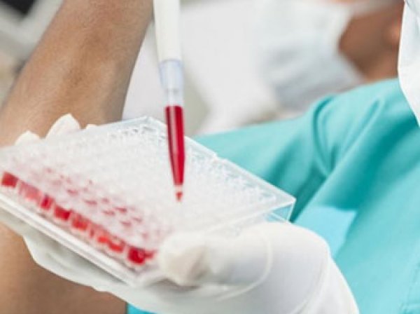 Ученые бьют тревогу: в России появился более опасный штамм ВИЧ