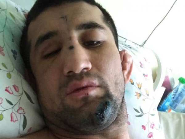 Расул Мирзаев, последние новости: боец MMA впервые рассказал о нападении (ФОТО)