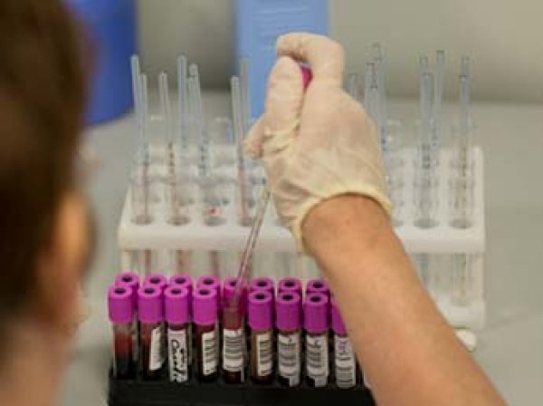 Ученые вычислили, как и когда на Земле появился ВИЧ