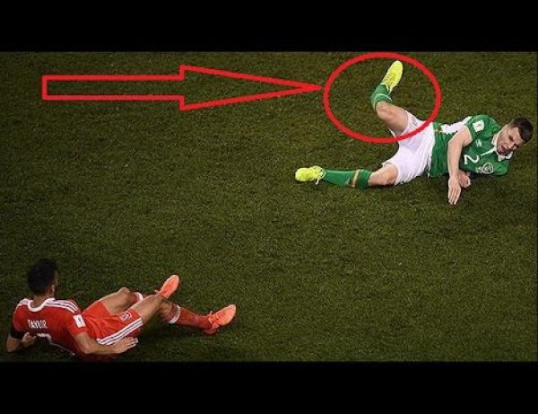 YouTube шокирован ВИДЕО, как капитану сборной Ирландии сломали ногу в матче с Уэльсом