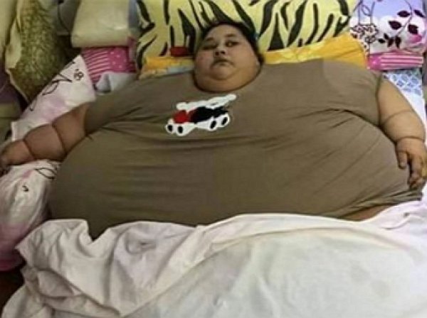Самая толстая женщина в мире похудела на 140 килограммов