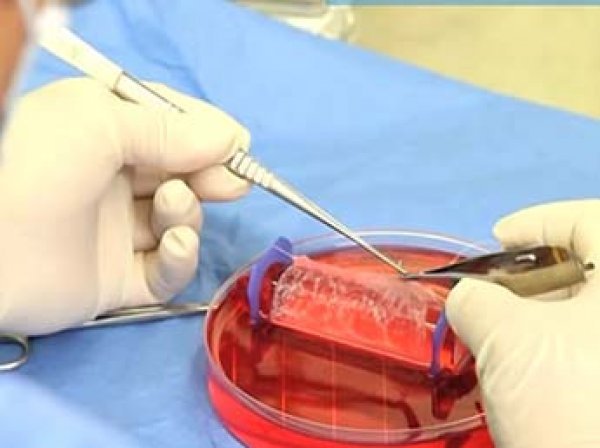 Канадские ученые вырастили уши из яблок