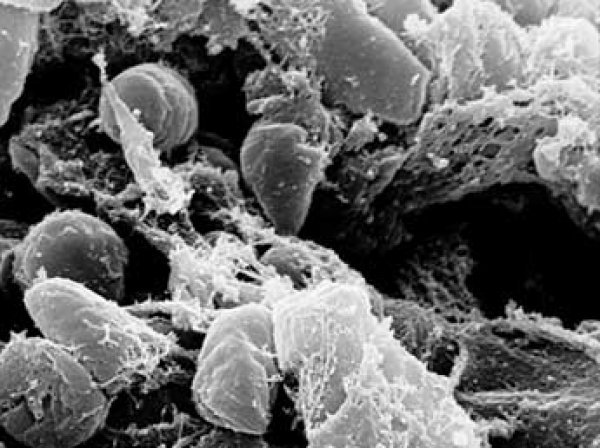 Ученые нашли новый вид плесени, которая "ест" пластик