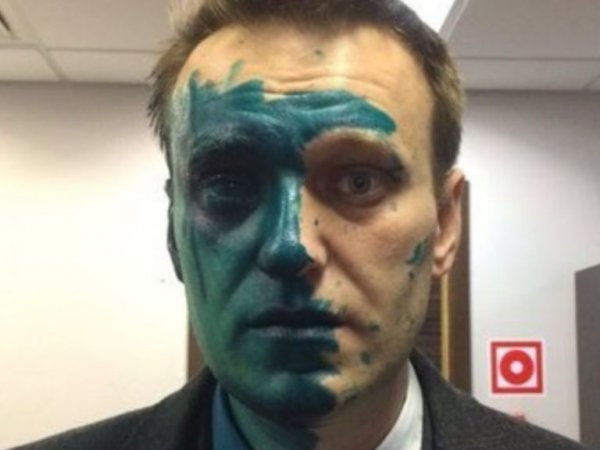 "Видон специфический": Навальный выложил в Instagram фото после операции в Барселоне