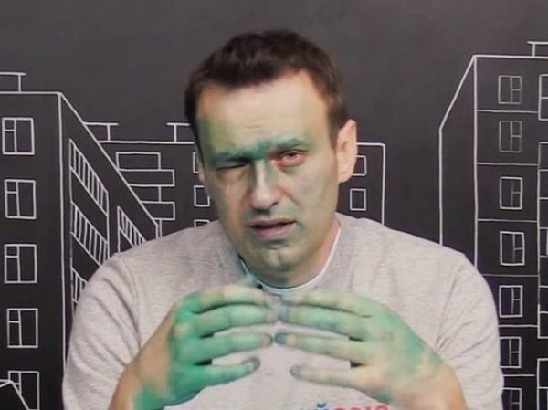 Навальный показал ФОТО еще двух нападавших и признал, что на 80% ослеп одним глазом