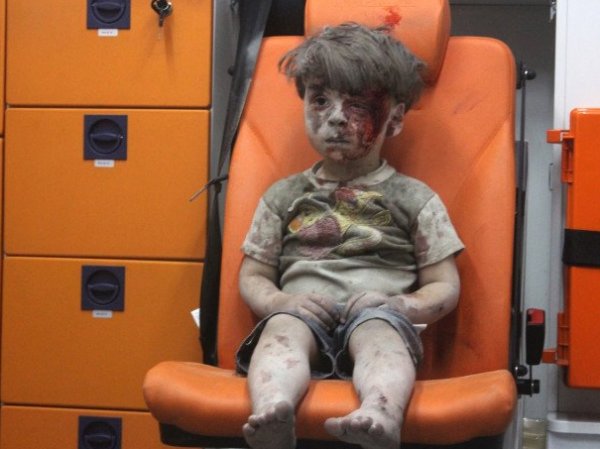 Журналистам впервые показала мальчика, ставшего "символом страданий в Алеппо" (ФОТО)