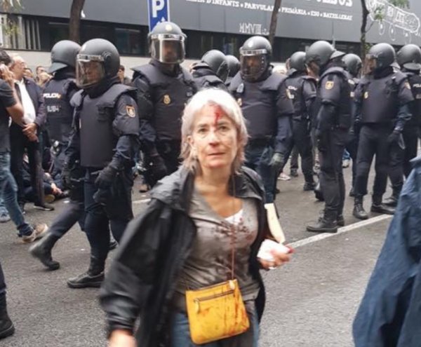 На референдуме в Каталонии пролилась первая кровь (ФОТО, ВИДЕО)