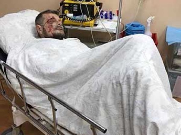 В МВД Украины заговорили о причастности Кадырова к покушению на Мосийчука
