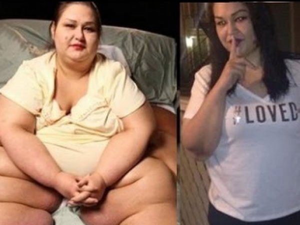 Самая толстая женщина в мире похудела на 403 кг