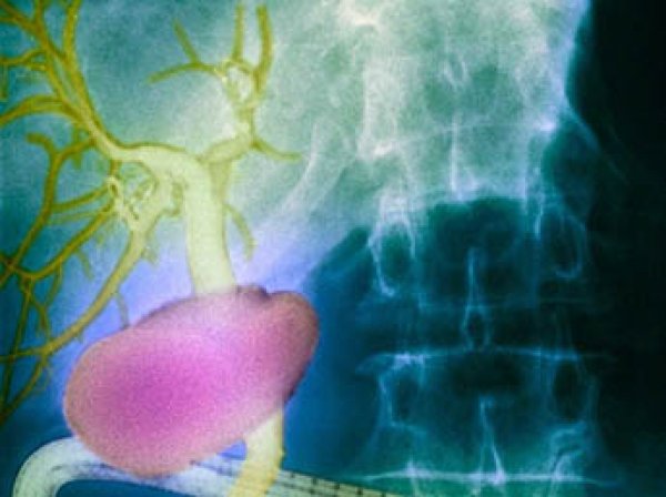 Ученые обнаружили неизвестный орган-бронежилет в теле человека