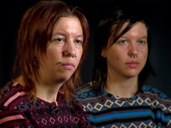 В США покончили с собой сестры-близнецы, которым в мозг вживили электроды