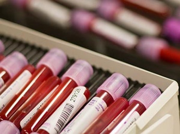 Ученые назвали самую смертоносную группу крови человека
