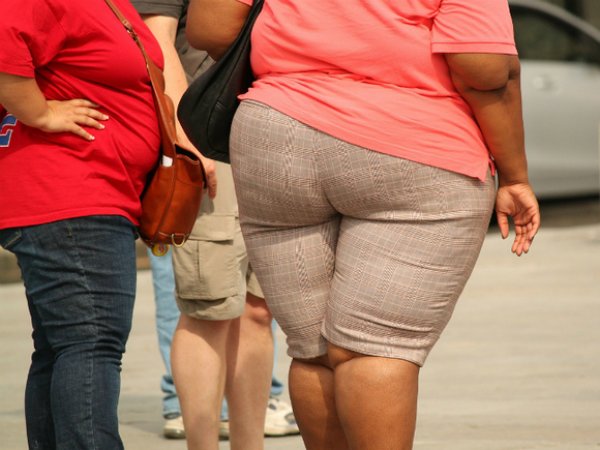 Минздрав обнародовал рейтинг самых страдающих от ожирения регионов России