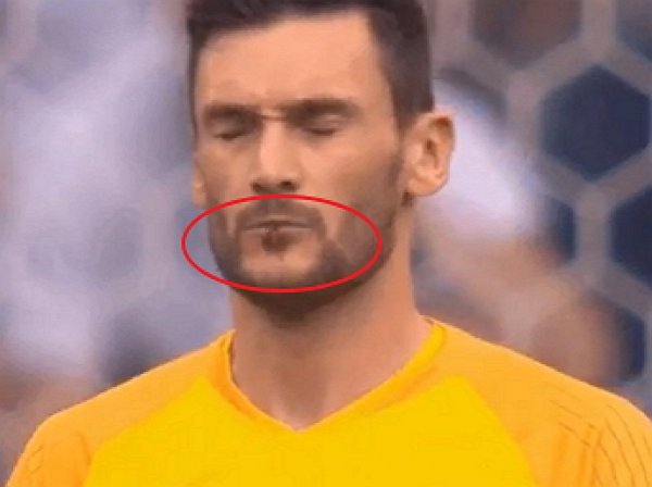 Уго Льорис со стрекозой во рту стал мемом после матча Уругвай — Франция