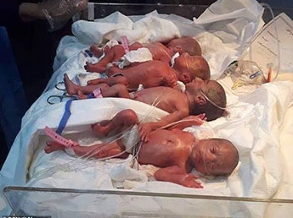 Родившиеся у многодетной матери семеро близнецов погибли в больнице