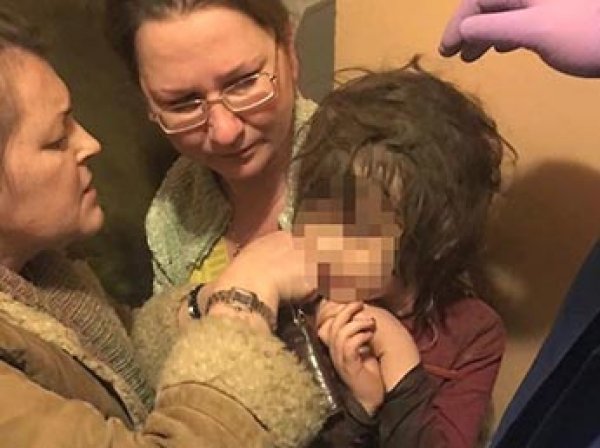 В заваленной мусором квартире в Москве нашли пятилетнюю девочку-маугли с вросшей в шею резинкой