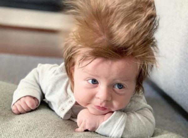 Сверхволосатый малыш стал звездой в Сети