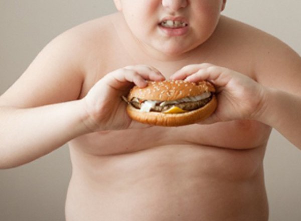Медики назвали причину детского ожирения