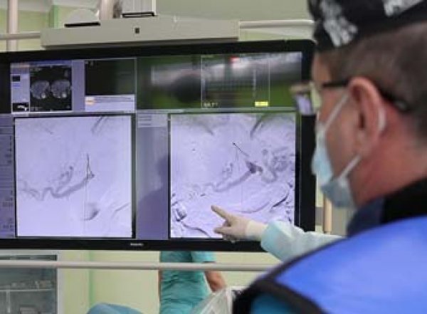 Медики озвучили главные симптомы опухоли мозга