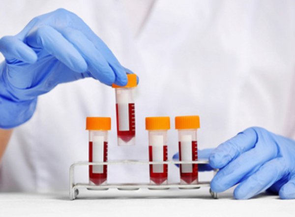 Врачи назвали 8 "ненужных" анализов, на которые не стоит тратить деньги