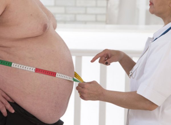 Медики рассказали о необычной причине ожирения