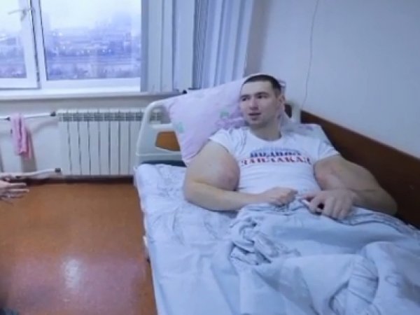 "Ужас-ужас, худой-худой": видео с операции по удалению "рук-базук" Кирилла Терешина появилось в Сети