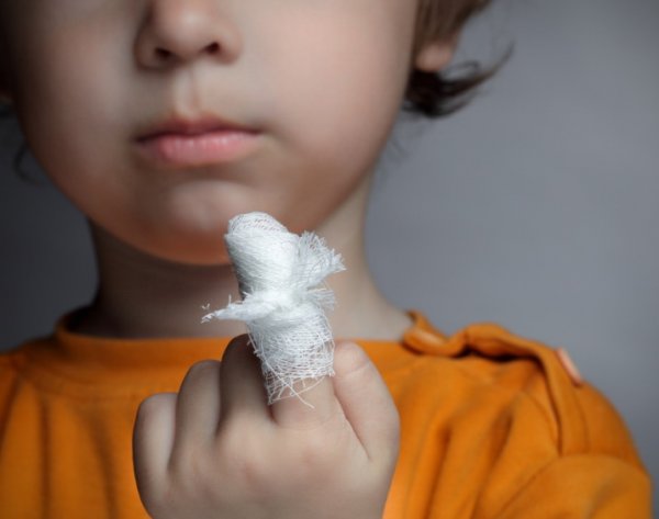 Как правильно лечить небольшую рану у детей, чтобы не было грубого рубца