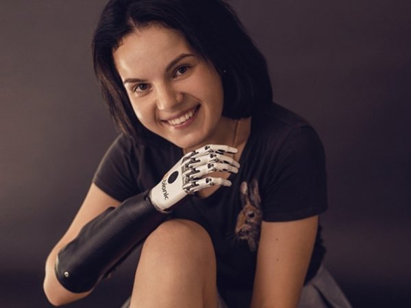 Оставшаяся без рук из-за мужа-изувера Маргарита Грачева получила 200 рублей алиментов