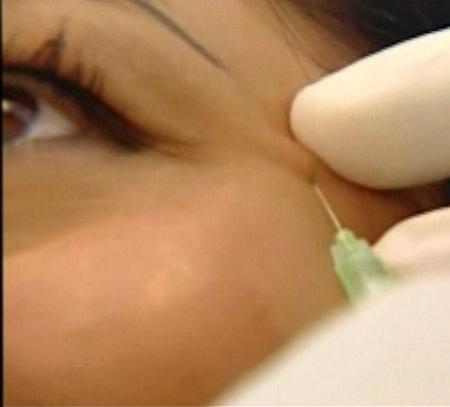 Звезды, которые пожалели, что сделали пластическую операцию