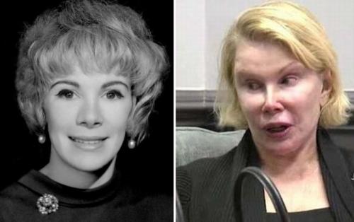 Звезды, которые пожалели, что сделали пластическую операцию