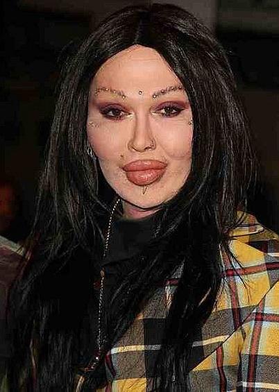 Звезды, которые пожалели, что сделали пластическую операцию