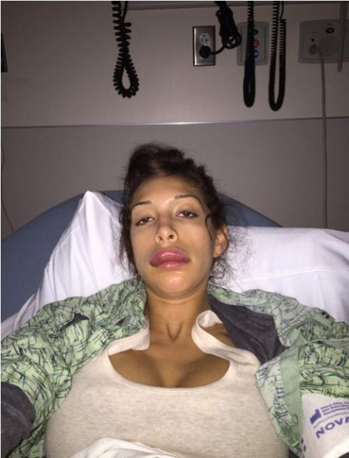 Звезды, которые пожалели, что сделали пластическую операцию