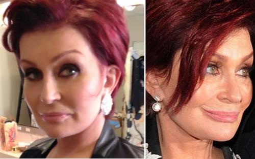 Звезды, которые пожалели, что сделали пластическую операцию