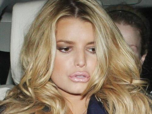 Звезды, которые пожалели, что сделали пластическую операцию