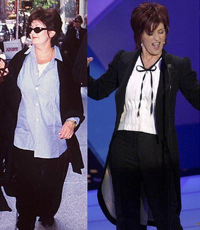 Звезды, которые пожалели, что сделали пластическую операцию