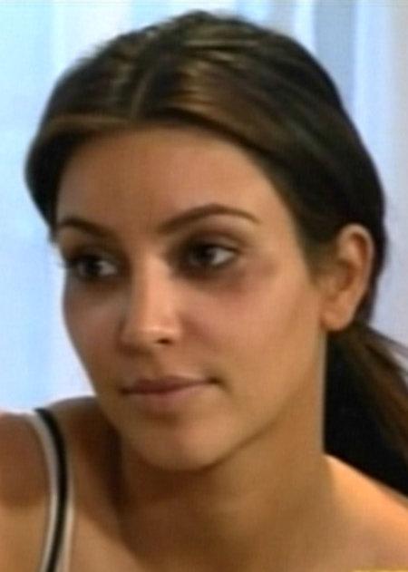 Звезды, которые пожалели, что сделали пластическую операцию