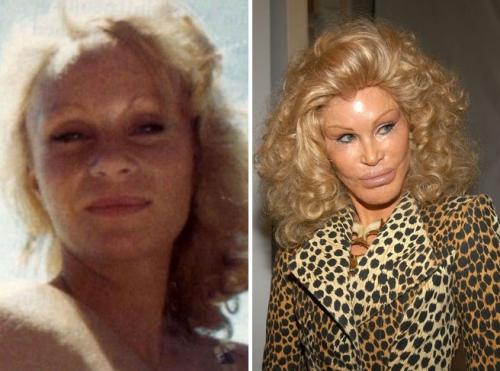 Звезды, которые пожалели, что сделали пластическую операцию