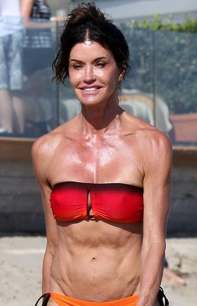 Звезды, которые пожалели, что сделали пластическую операцию