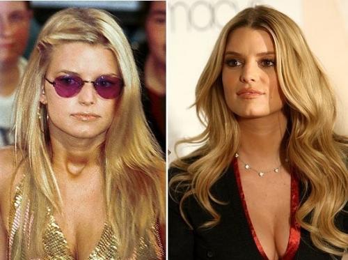 Звезды, которые пожалели, что сделали пластическую операцию