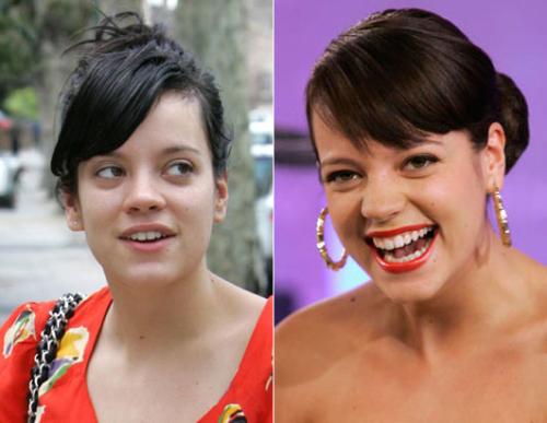 Звезды идут на эксперименты с лицом