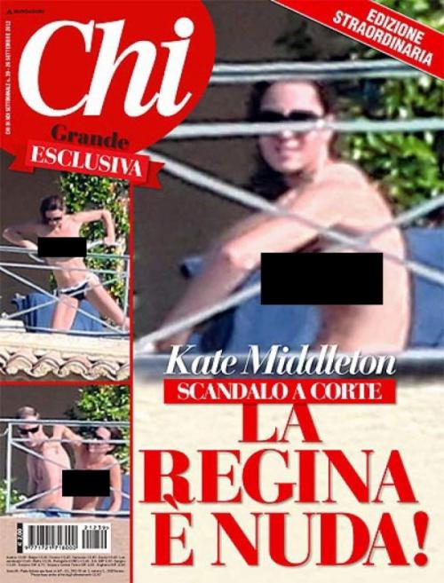 Звезды во всем своем безобразии: самые скандальные снимки папарацци