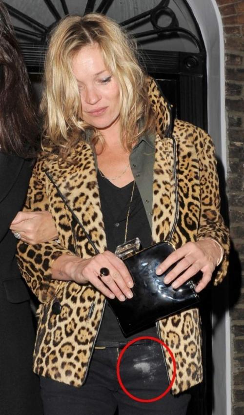 Звезды во всем своем безобразии: самые скандальные снимки папарацци