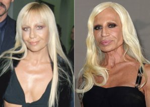 Звезды Голливуда до и после пластических операций